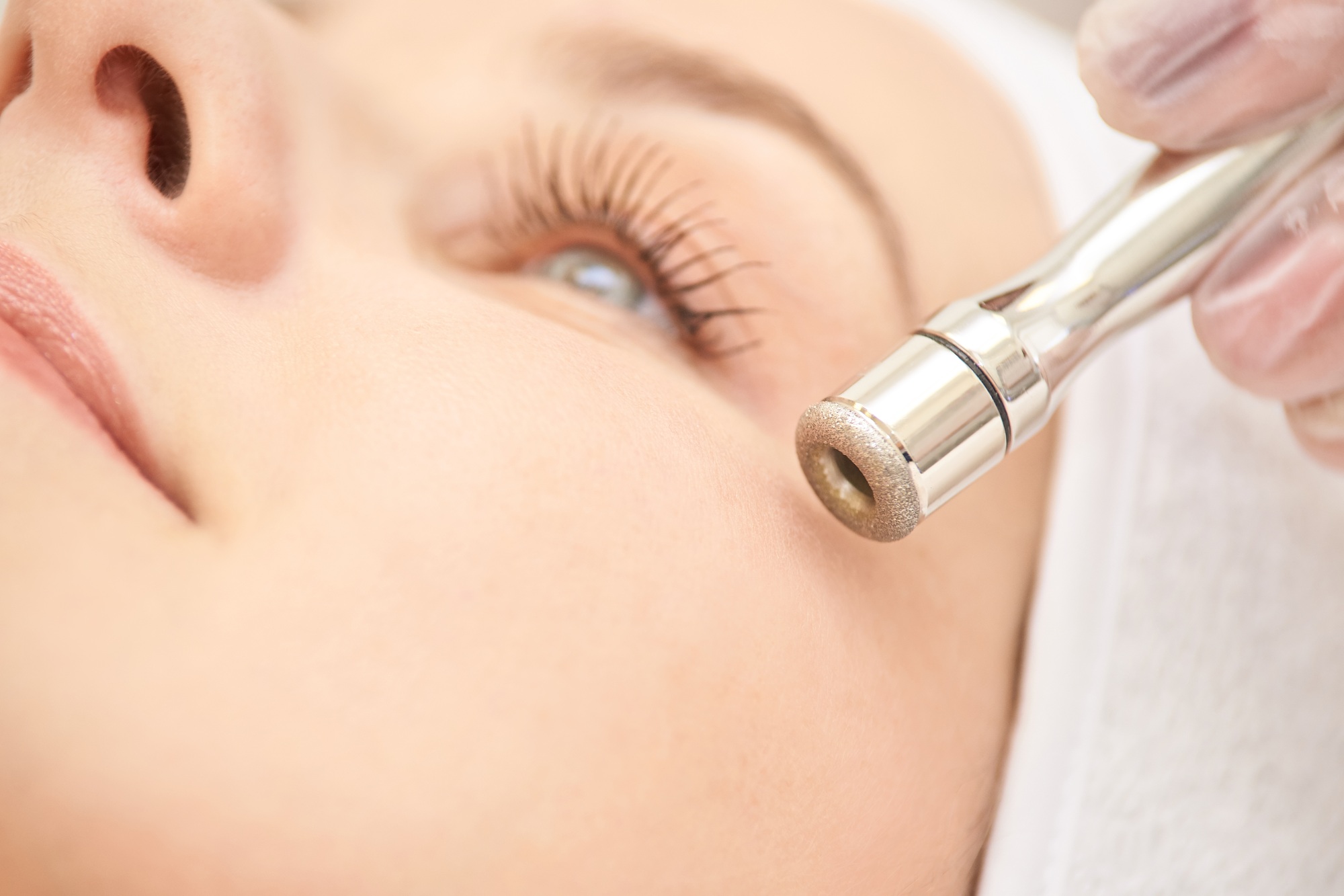 Microdermabrasion clinic treatment. Aesthetic facial procedure. Diamond face clean. Medicine beauty